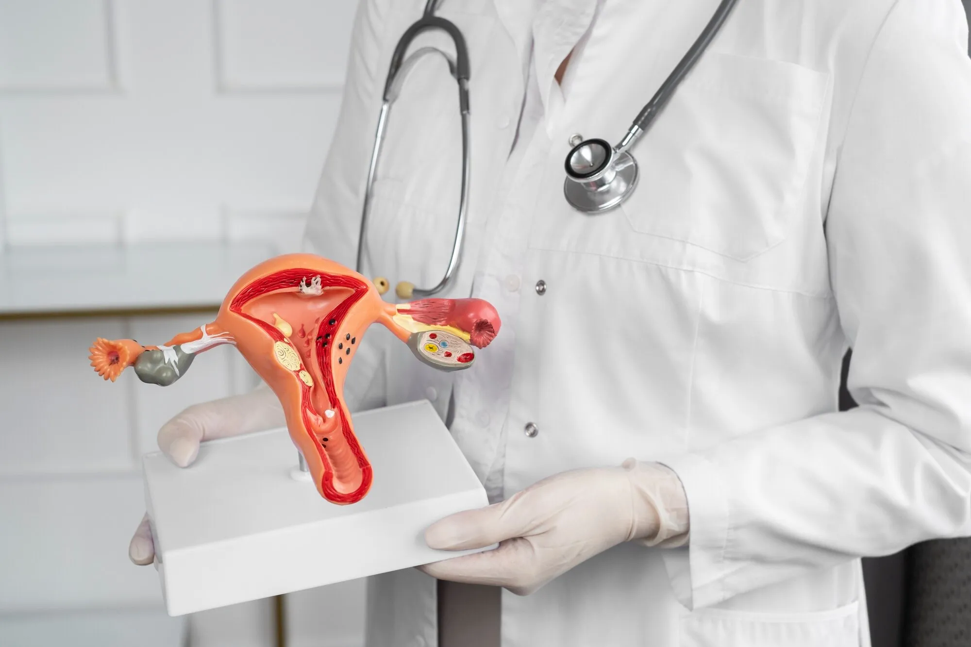 Modelo anatómico de útero y ovarios en manos de la doctora