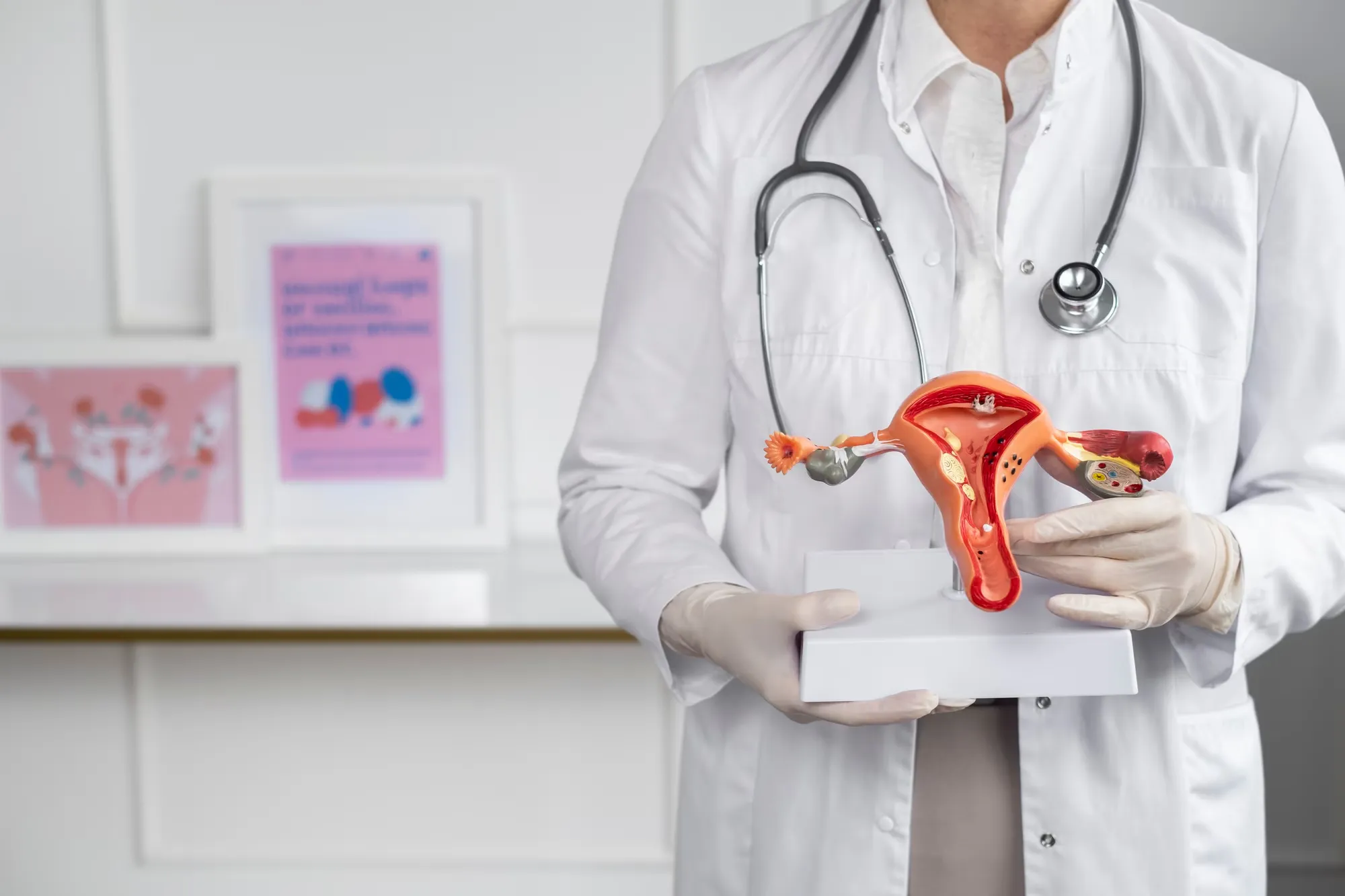 Doctora sosteniendo un modelo anatómico de útero y ovarios